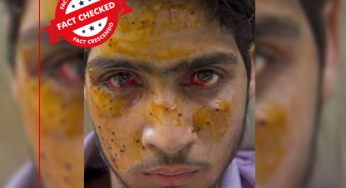 असंबंधित और पुरानी तस्वीर को किसान आंदोलन में घायल किसान के नाम से शेयर किया जा रहा है।